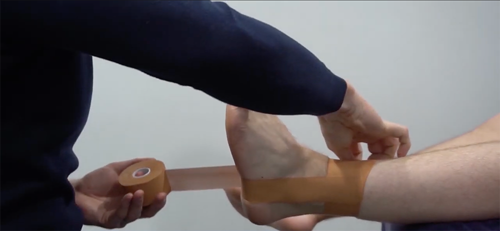 Ankle contour in sports physio ankle strapping